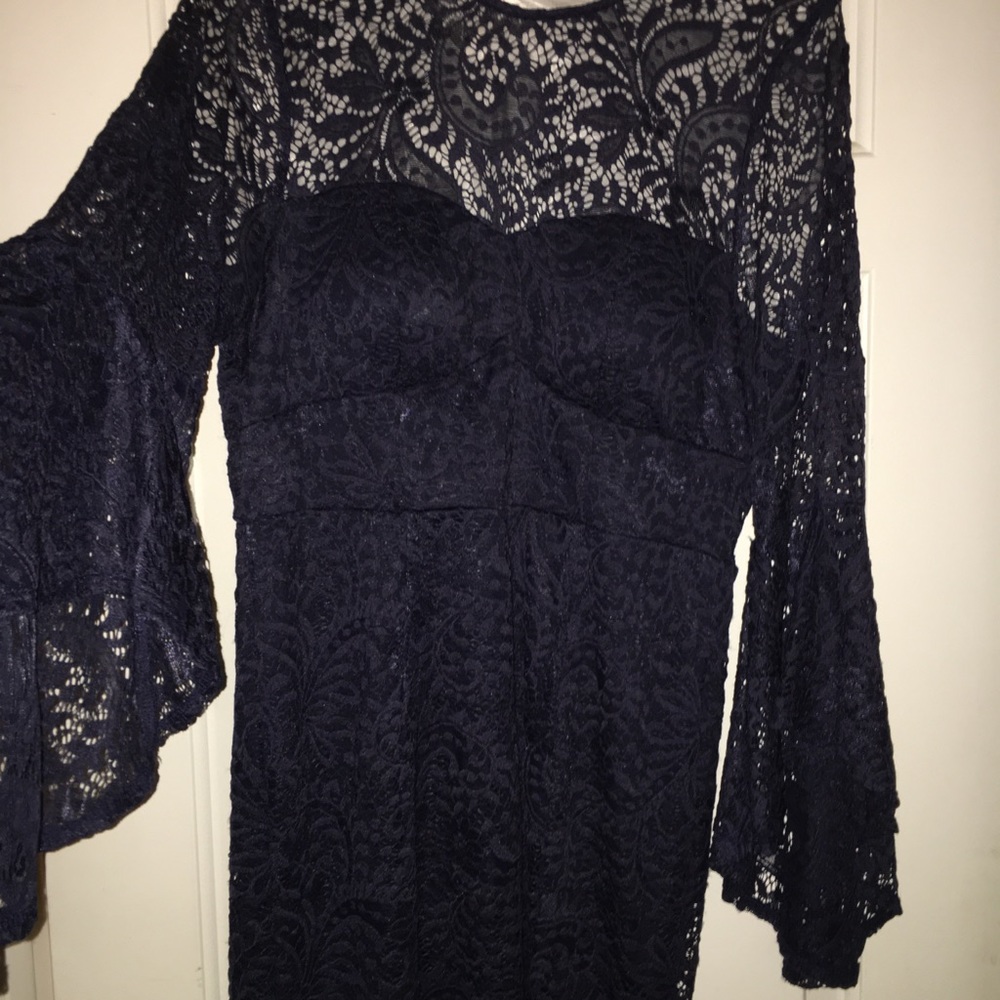 💙 Lace Dress 👗